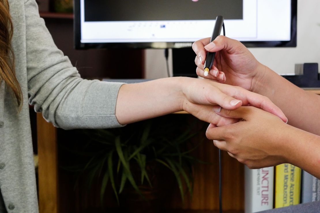 The photo captures an AcuGraph session at AcuGift in Charlotte, where a computer measures electrical skin resistance at specific points along the meridians of the body. The AcuGraph system charts this data visually, helping the acupuncturist identify imbalances in energy flow. This advanced technology enhances the acupuncture session, providing real-time insights for a more personalized and effective treatment.