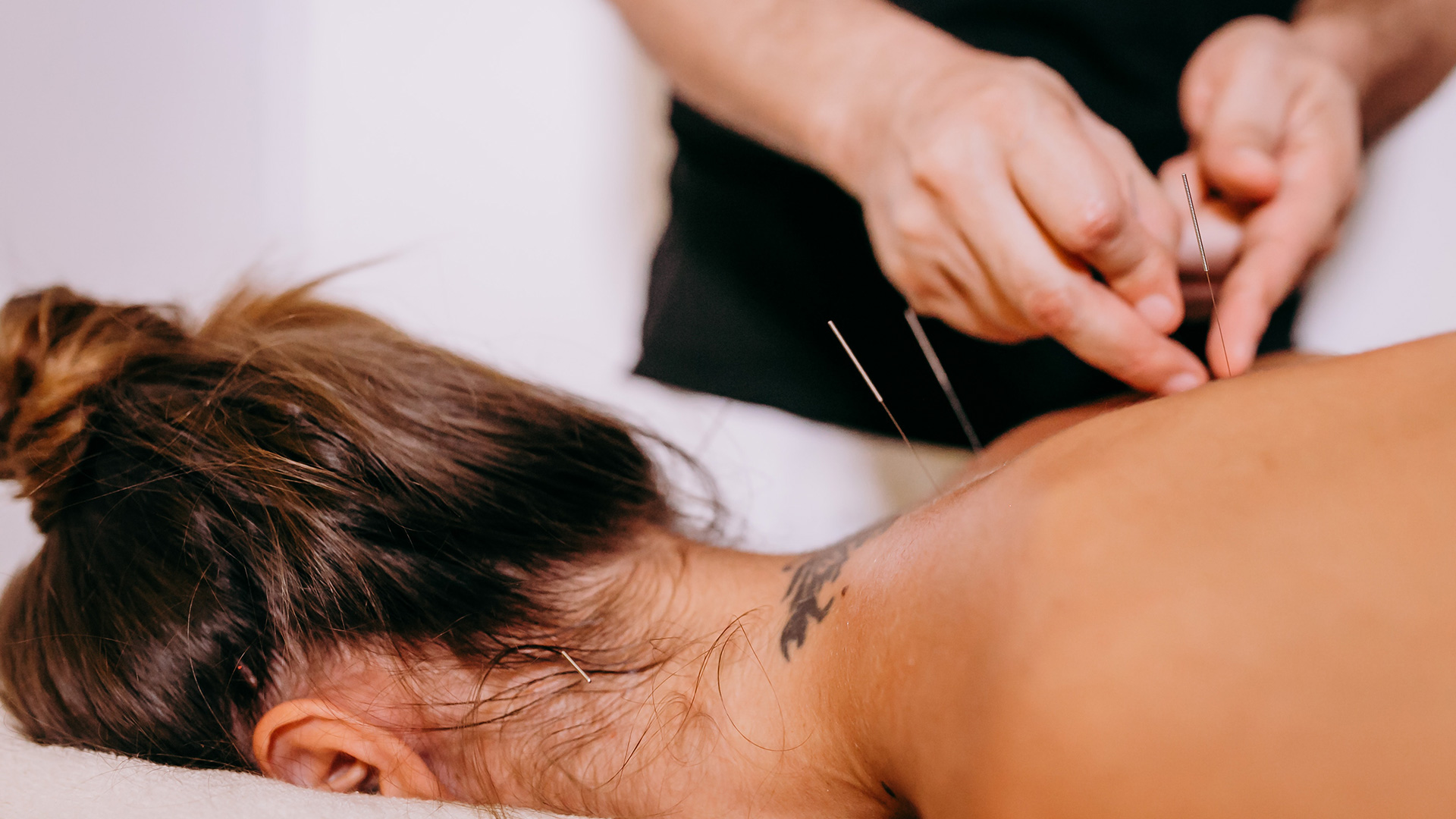 The photo features a woman receiving electroacupuncture on her back in a serene setting in Charlotte. Electrodes are attached to acupuncture needles strategically placed along her spine, delivering gentle electrical pulses. This advanced technique enhances traditional acupuncture benefits, such as pain relief, improved circulation, and muscle relaxation.